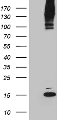 SUMO1 / SMT3 Antibody (clone OTI1E8)
