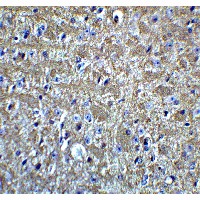 OLIG2 Antibody