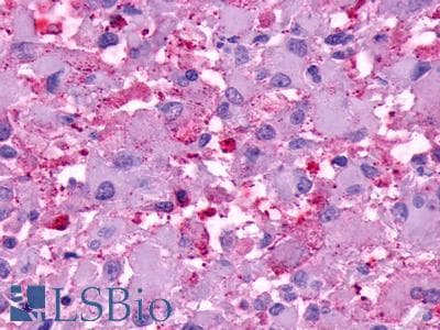 PathPlus™ Polyclonal Rabbit anti-Human GPR20 Antibody (C-Terminus, IHC)