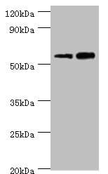 Polyclonal Rabbit anti-Human DFNA5 Antibody (aa1-260, IHC, WB)