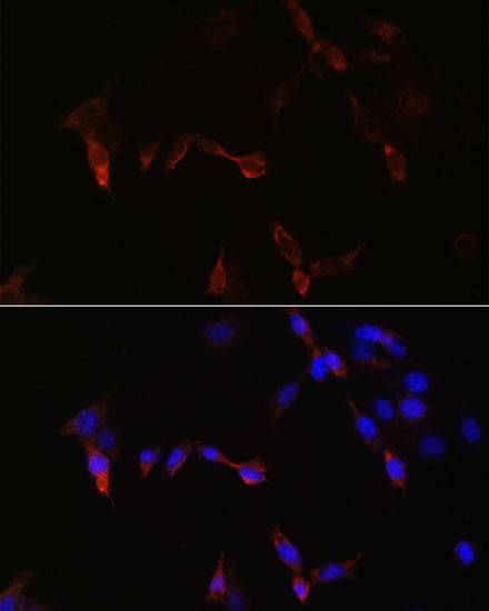 PLA2G5 Antibody