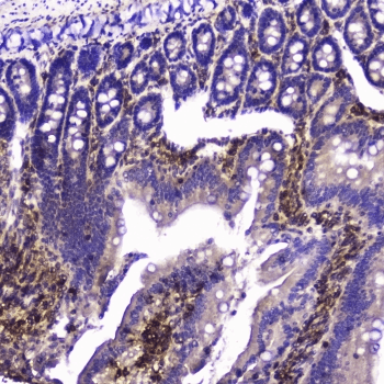 TLN1 / Talin 1 Antibody