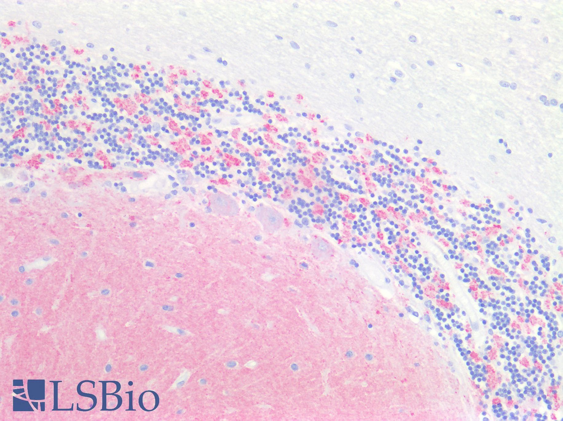 IHC-plus™ Polyclonal Rabbit anti-Human SYP / Synaptophysin Antibody (IHC, WB)