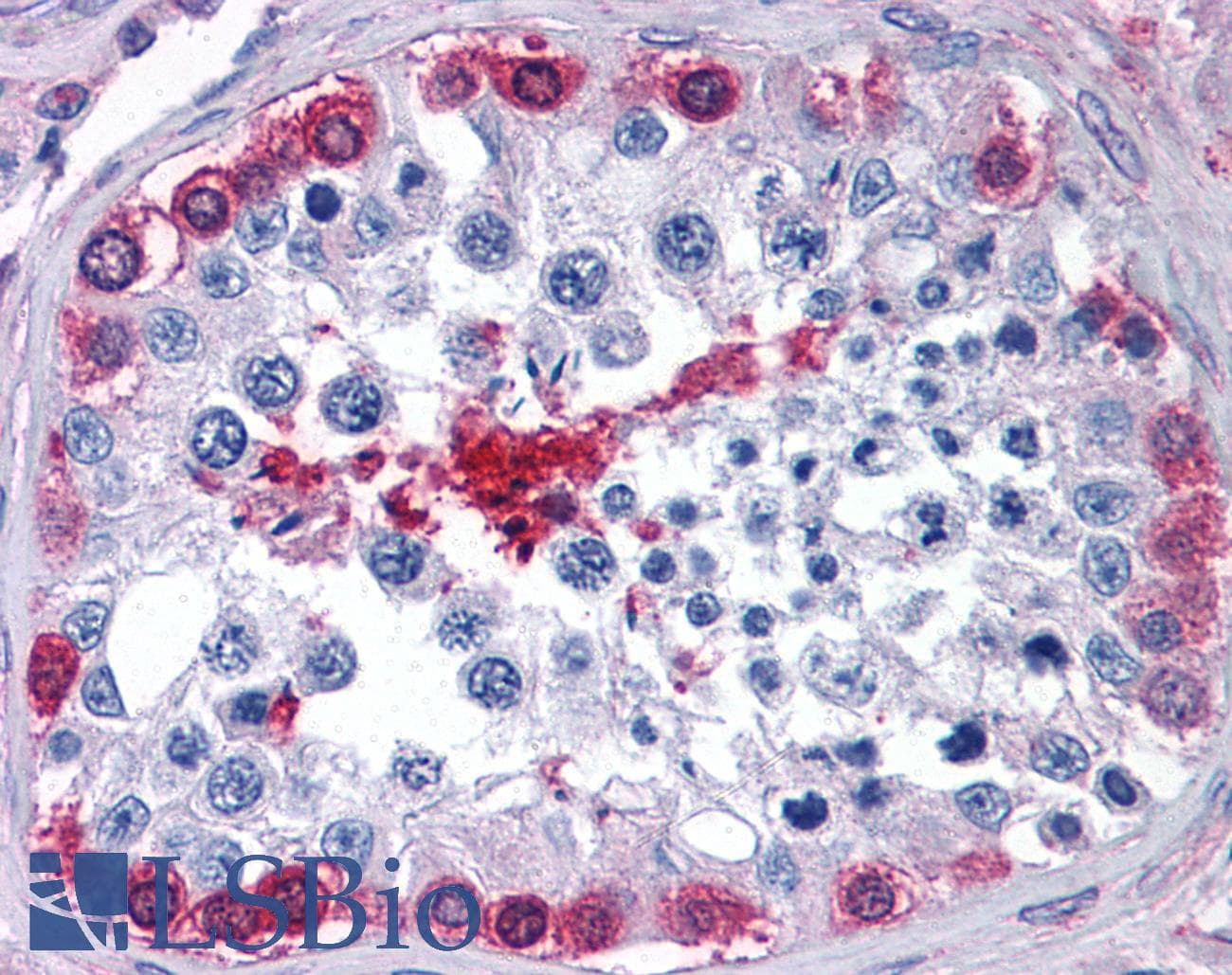IHC-plus™ Polyclonal Goat anti-Human GPI Antibody (aa120-132, IHC, WB)
