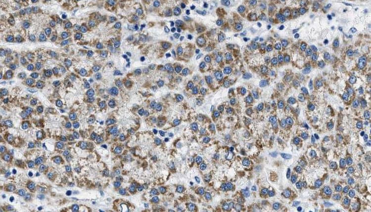 PIK3CG / PI3K Gamma Antibody