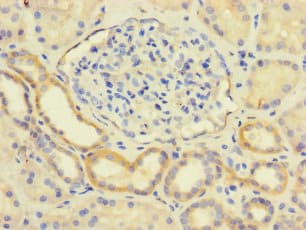 Polyclonal Rabbit anti-Human LY96 / MD2 / MD-2 Antibody