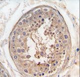 SPAG9 Antibody (aa603-632)