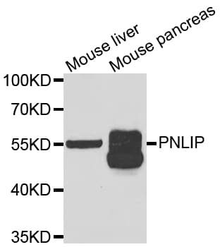 PNLIP / PL / Pancreatic Lipase Antibody