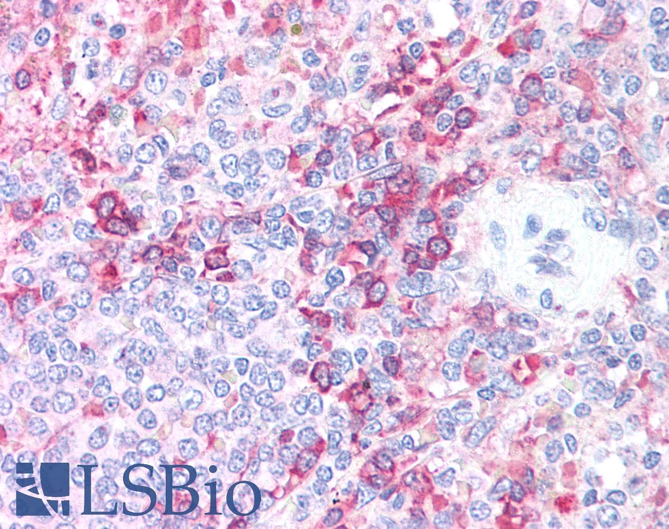 IHC-plus™ AURKB / Aurora-B Antibody