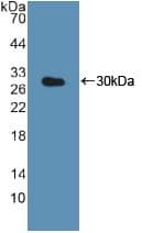 CTSK / Cathepsin K Antibody (aa54-317)