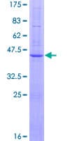 Human BBS10 Protein (Recombinant GST)
