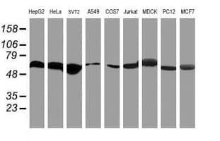 RNF113B Antibody (clone OTI2C10, Carrier-free)