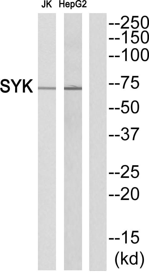 SYK Antibody (Ab-352)