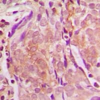 ZNF397 Antibody (N-Terminus)