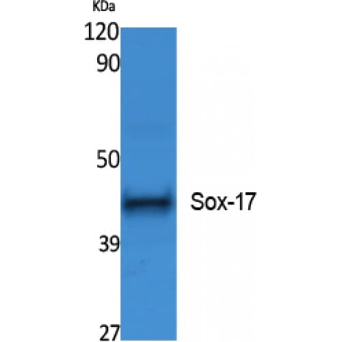 Polyclonal Rabbit anti-Human SOX17 Antibody (90-170 aa, Internal, WB)