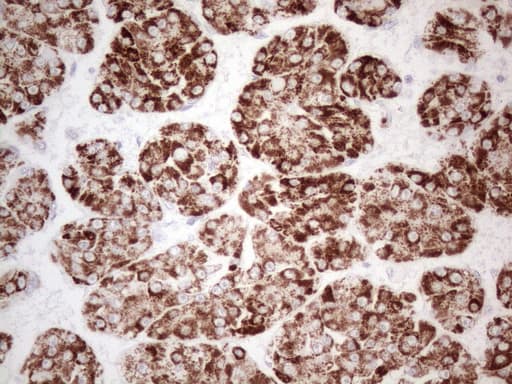AMACR / P504S Antibody (clone OTI3E10)