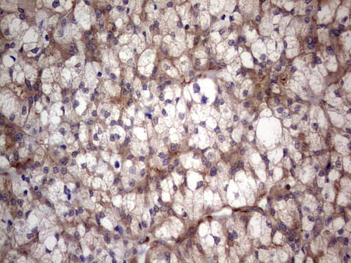 LGALS3 / Galectin 3 Antibody (clone OTI6E1)