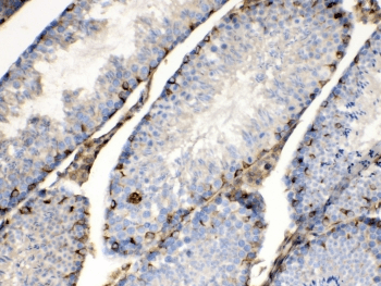 BAG1 / BAG-1 Antibody