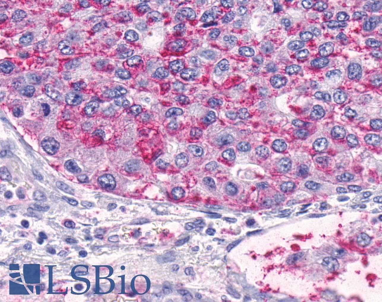 PathPlus™ ADGRA2 / GPR124 Antibody (N-Terminus)
