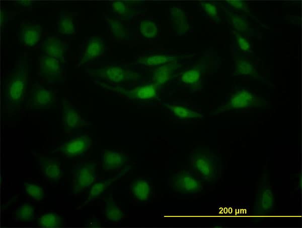 IHC-plus™ STAT5B Antibody (clone 2D1)