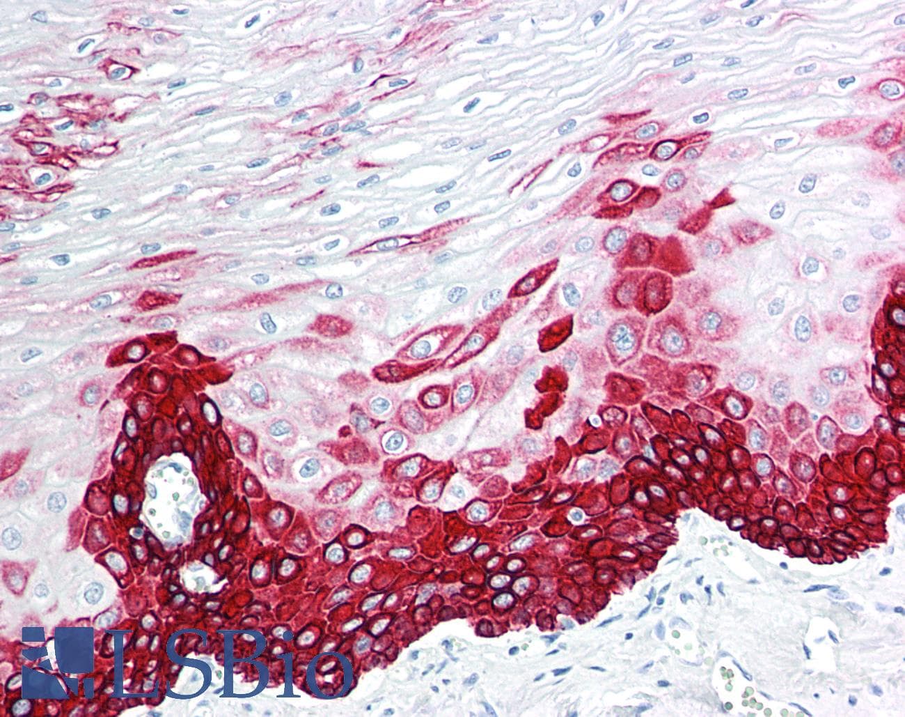 PathPlus™ Monoclonal Mouse anti-Human KRT15 / CK15 / Cytokeratin 15 Antibody (IHC, WB)