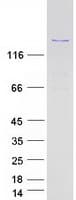 Human PPP1R13B Protein (Recombinant Myc-DDK (Flag))