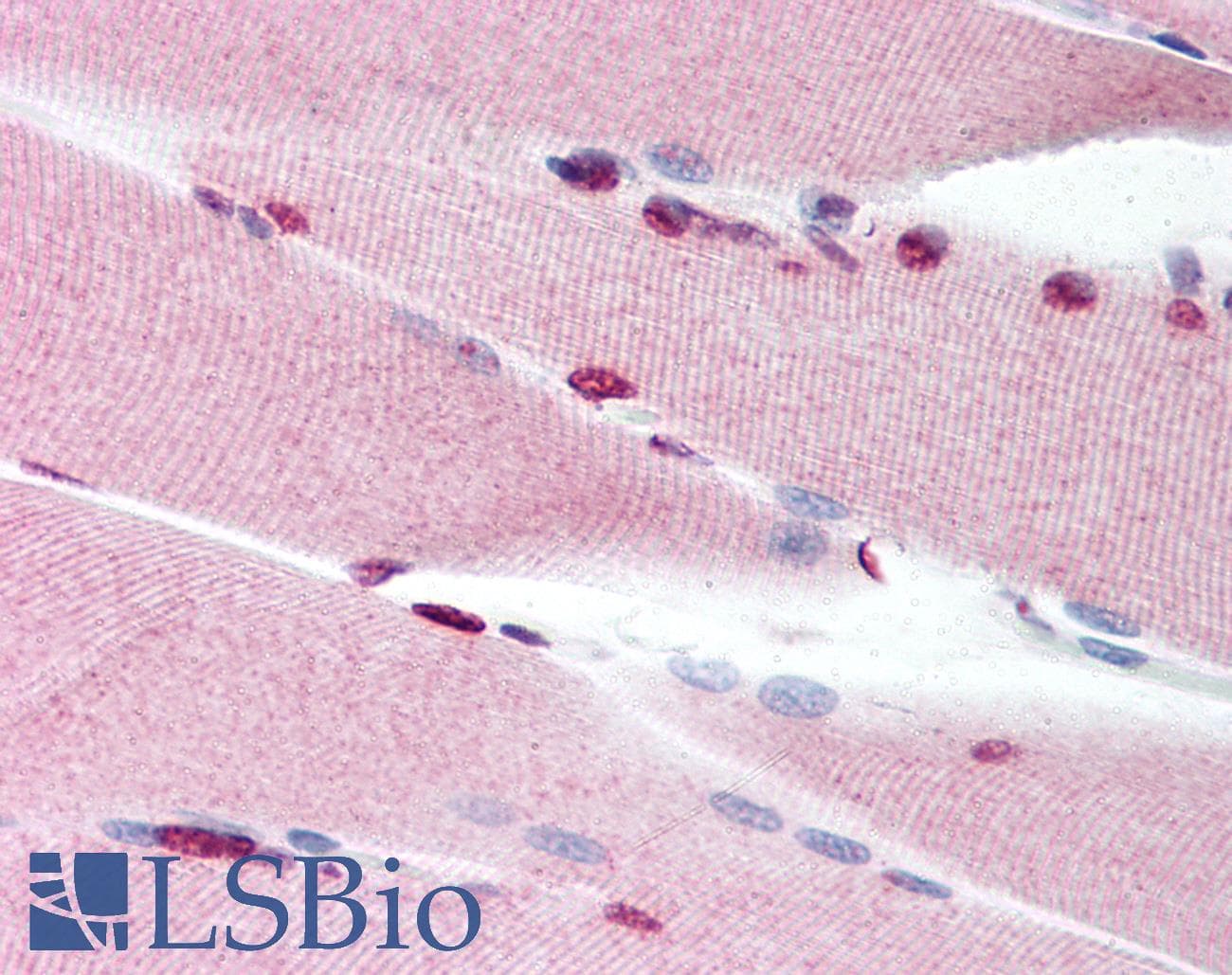 IHC-plus™ TP53BP1 / 53BP1 Antibody (C-Terminus)