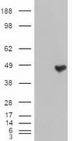 Monoclonal Mouse anti-Human CPA1 / Carboxypeptidase A Antibody (clone OTI2A3, IHC, IF, WB)
