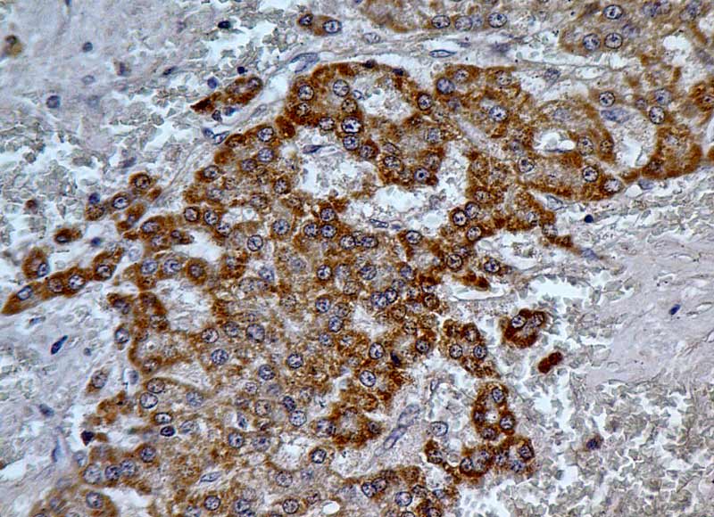 Monoclonal Mouse anti-Mouse PD-L2 / PDCD1LG2 / CD273 Antibody (IHC, WB)
