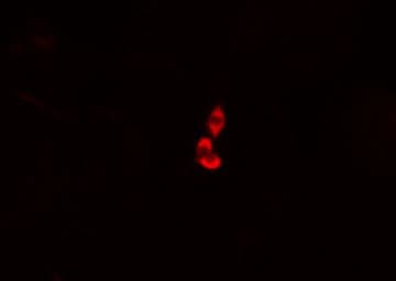 Polyclonal Rabbit anti-Human COMT Antibody (IF, WB)