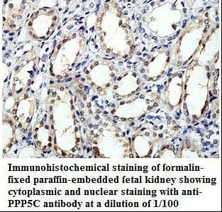 Polyclonal Rabbit anti-Human PPP5C Antibody (aa223-487, IHC, WB)