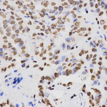Histone H4 Antibody (Di-Methyl-Lys20)