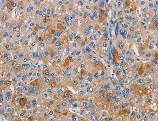 Polyclonal Rabbit anti-Human PIKFYVE / PIP5K Antibody (IHC)