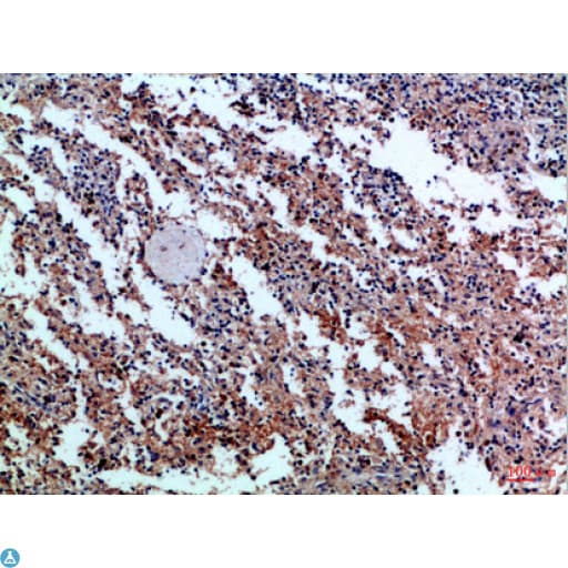 GP1BB / CD42c Antibody
