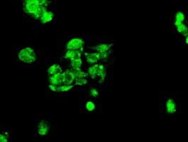 IHC-plus™ KIND2 / FERMT2 Antibody (clone 9E4)