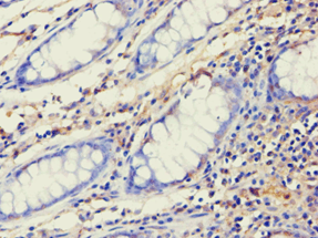 AES / Groucho Antibody (aa1-264)