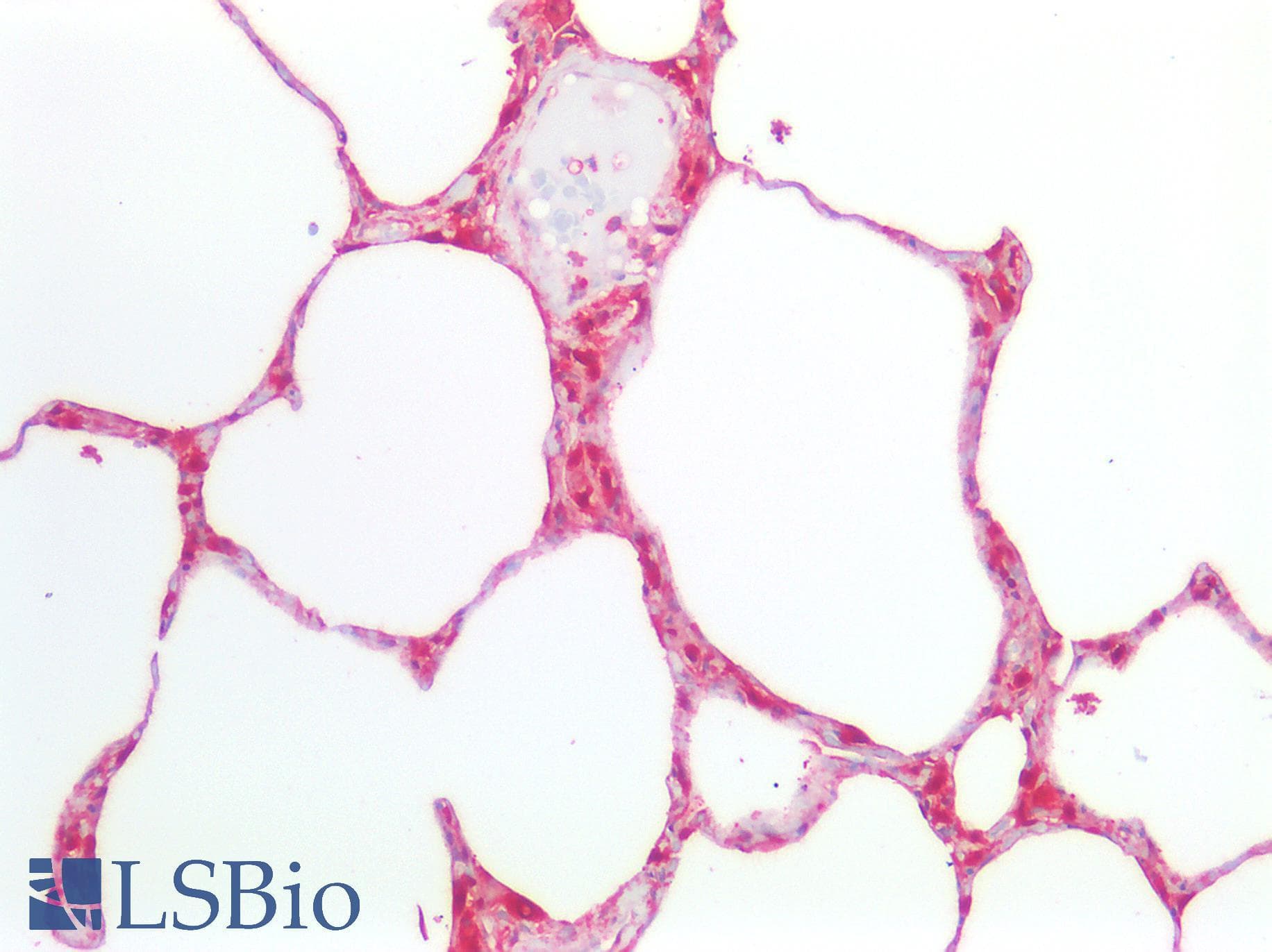 PathPlus™ Polyclonal Rabbit anti-Human ENO1 / Alpha Enolase Antibody (IHC, IF, WB)