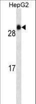 GSTA1 Antibody