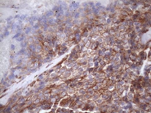 PDIA6 / ERP5 Antibody (clone OTI8H4)