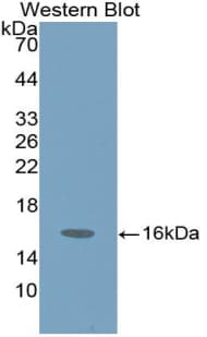 HEXB Antibody (aa315-456, Cy3)