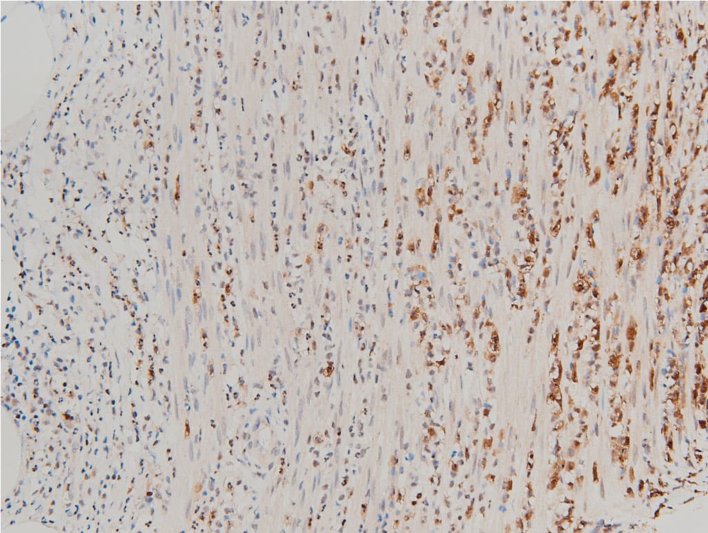 CFL1 / Cofilin Antibody (phospho-Ser3)