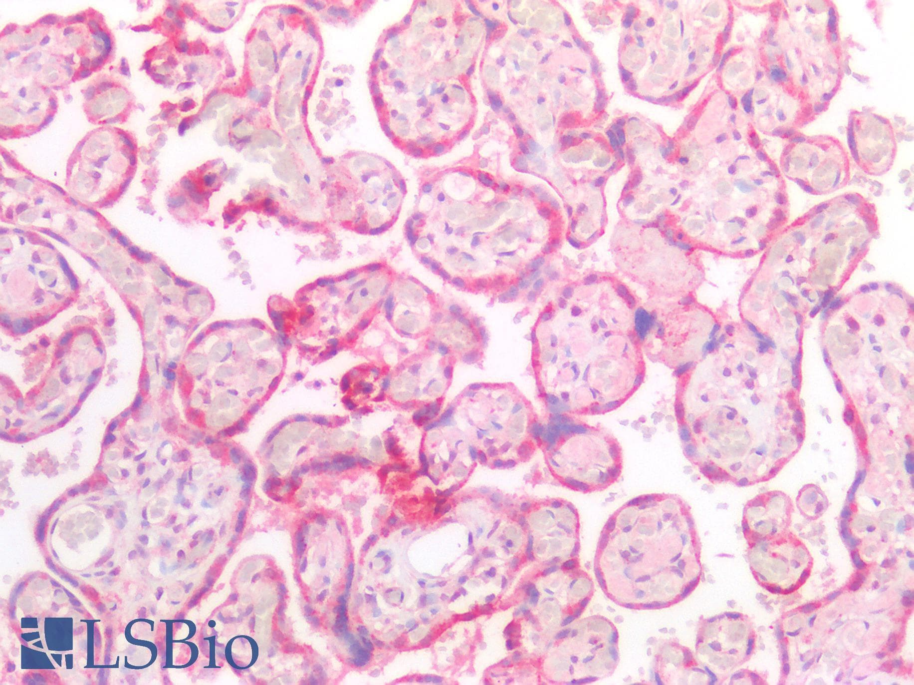 IHC-plus™ Polyclonal Rabbit anti-Human CTSK / Cathepsin K Antibody (IHC)