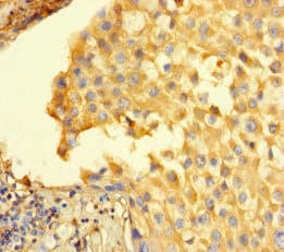 Polyclonal Rabbit anti-Human STIL Antibody (IHC, IF)