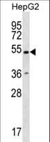 Polyclonal Rabbit anti-Human RNF38 Antibody (aa40-69, WB)