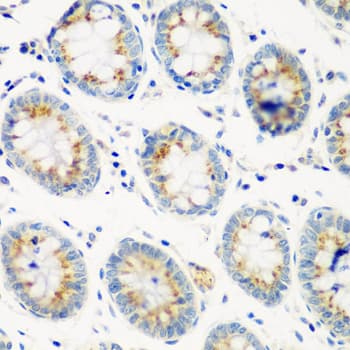 CTSG / Cathepsin G Antibody