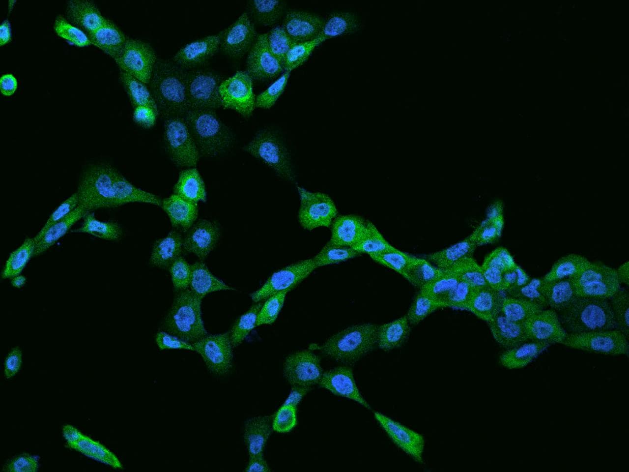 Polyclonal Rabbit anti-Human CASP4 / Caspase 4 Antibody (IF)