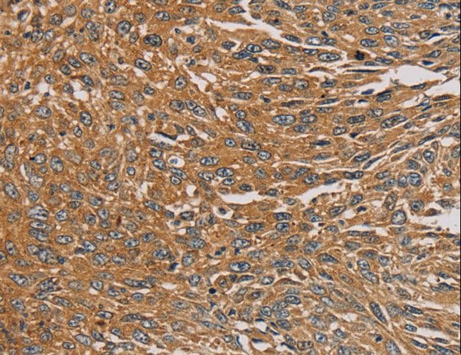 PARP11 Antibody