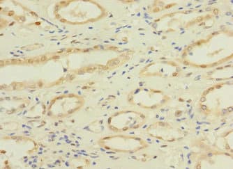 Polyclonal Rabbit anti-Human NAE1 / APPBP1 Antibody (IHC, WB)