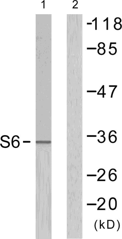 RPS6 / Ribosomal Protein S6 Antibody (p240/244)