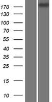 CDC42BPG Protein (Over-Expression Lysate Myc-DDK (Flag))